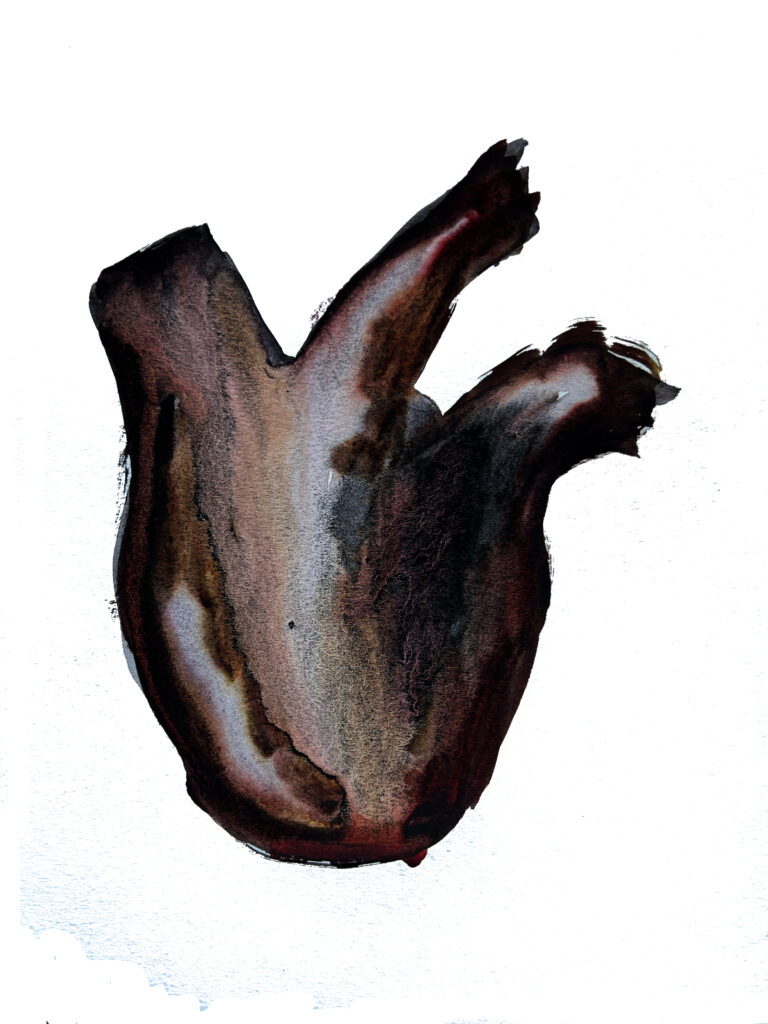 Coronary. Watercolor. Janice Greenwood.